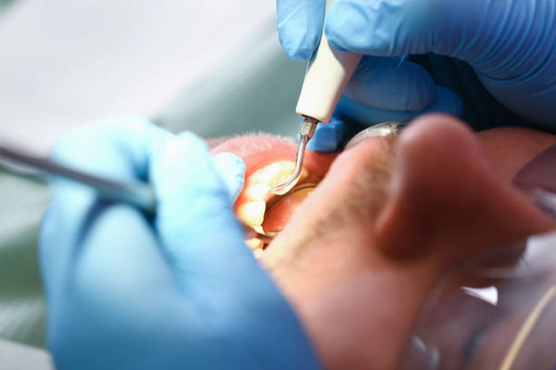 Best Tooth Pain Emergency Relief  in Frederick, MD